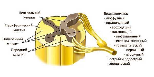 Ликвороманометрия (ЛМ)