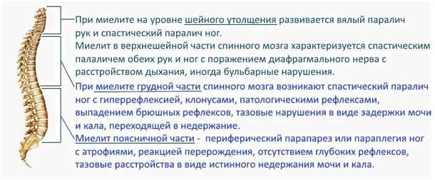 Миелит при дегенеративных заболеваниях позвоночника.