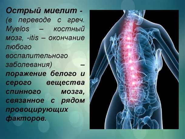 Миелит при онкологических заболеваниях.