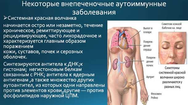 Лечение и прогноз поражения спинного мозга при аутоиммунных заболеваниях