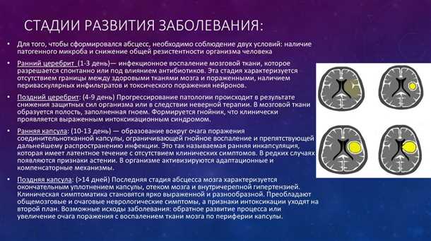 Роль воспаления и иммунных клеток в развитии патологического процесса