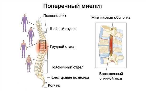 Лечение и реабилитация пациентов с поражением спинного мозга после воздействия радиации
