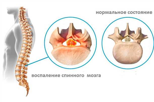 3. Нарушение функции мочеиспускания