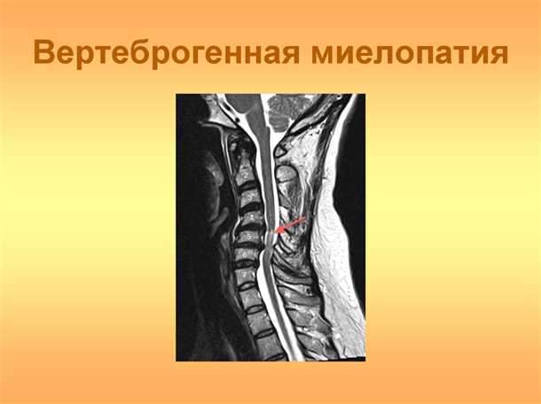 Принципы консервативного лечения