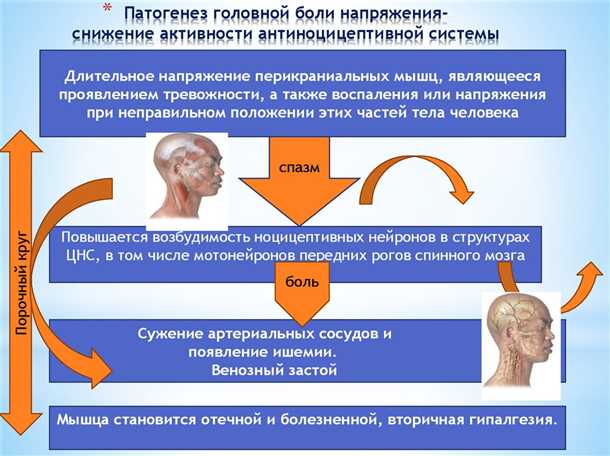 Связь мигрени с состоянием сосудов головного мозга