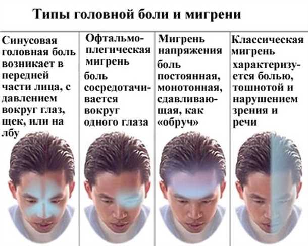 3. Альтернативные методы
