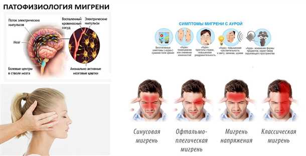  Альтернативные методы снижения симптомов мигрени 
