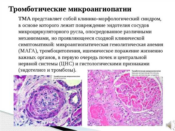 Влияние микроангиопатии на функционирование организма