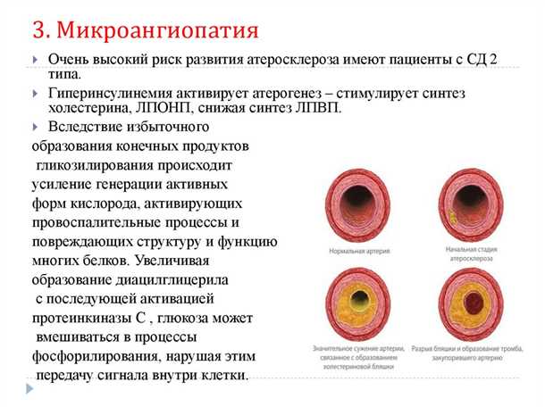 Микроангиопатия головного мозга: особенности диагностики и прогноза.