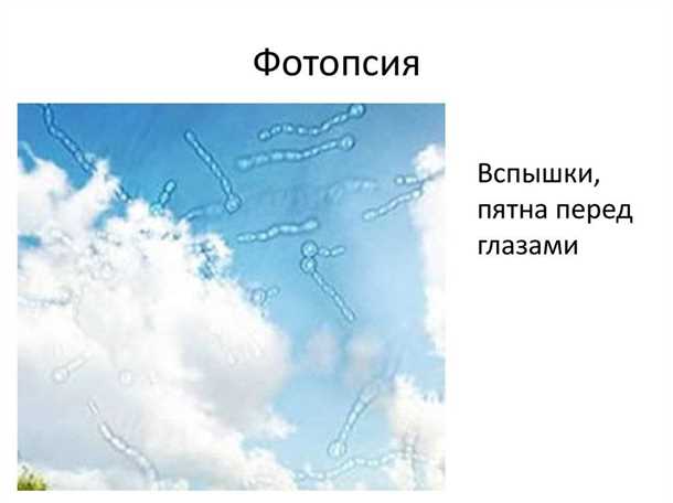 Причины появления молний перед глазами