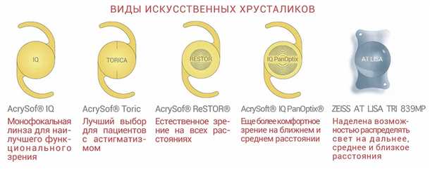 1. Коррекция дальнозоркости и близорукости