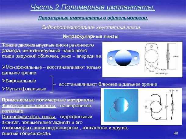 Плюсы и минусы мультифокальных ИОЛ