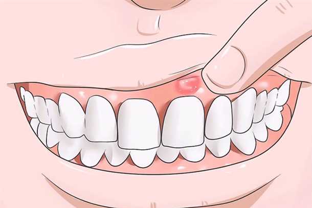 Когда нужно обратиться к стоматологу