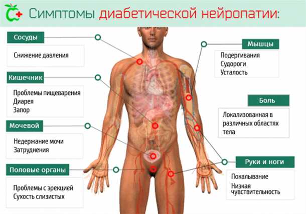 Нейропатия