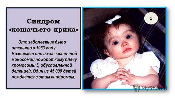 Лечение неонатального тетанического синдрома