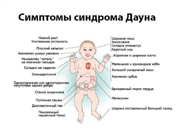 Диагностика проблемы у новорожденных