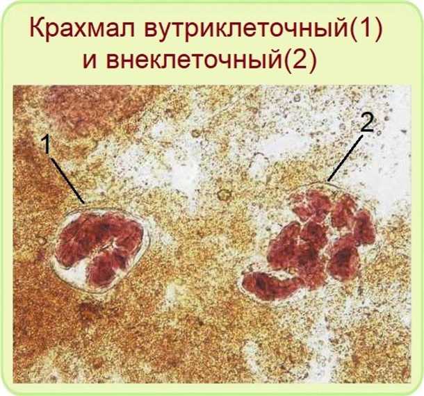 Что такое непереваренный крахмал в кале и почему это важно?