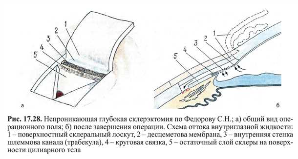 Послеоперационный период и реабилитация