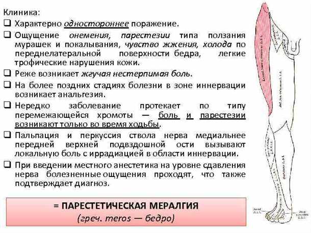 Невралгия бедренного нерва: клинические особенности и реабилитация.