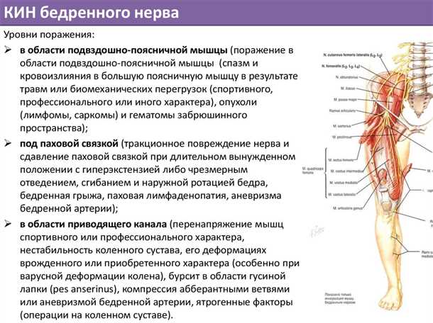 Причины возникновения невралгии брюшного сплетения