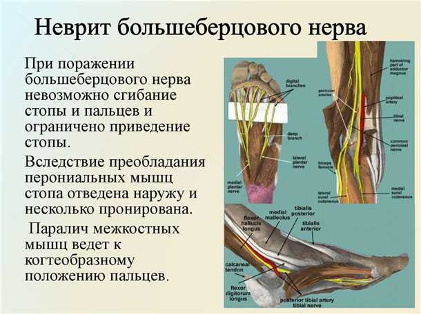 Фармакологическое лечение при невралгии спинного нерва