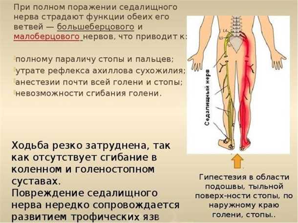 Невралгия глубоких ветвей спинного нерва: диагностика и терапия.
