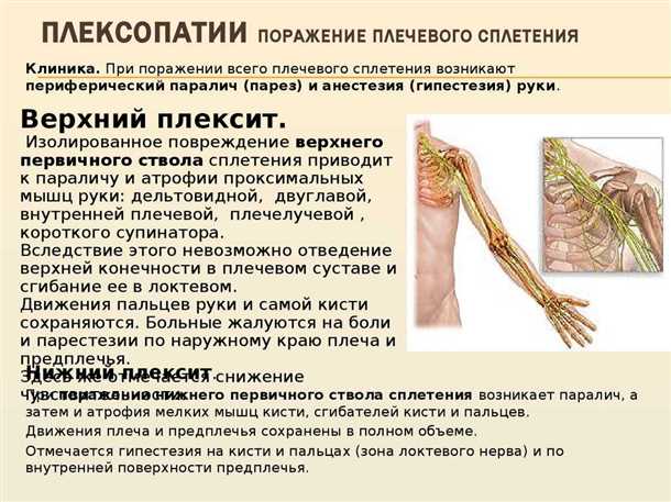 Методы диагностики и лечения невралгии грудного сплетения: актуальные подходы и современные направления исследований