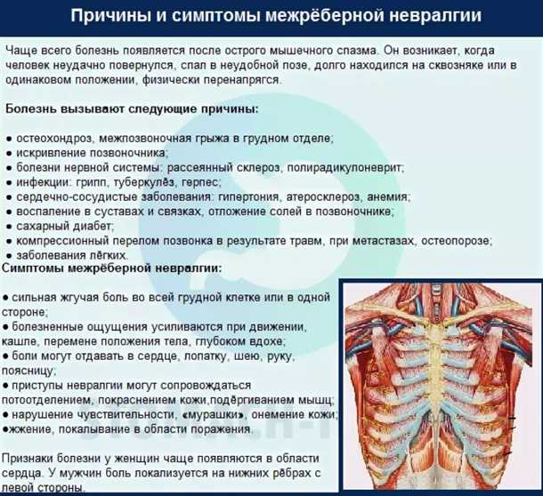 Невралгия грудного сплетения: клинические проявления и реабилитация.
