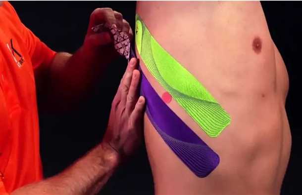 Невралгия косого и прямого мышца живота - изучаем симптомы, методы диагностики и эффективные подходы к реабилитации Невралгия косого и прямого мышца живота: диагностика и реабилитация.