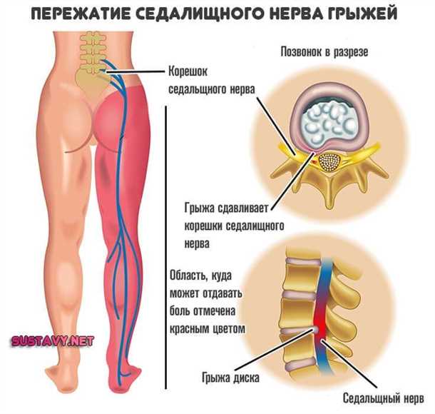 Ультразвуковая терапия