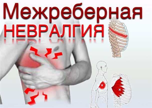 3. Упражнения и физическая активность