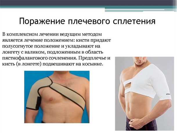 Невралгия плечевого сплетения: особенности диагностики и терапии.