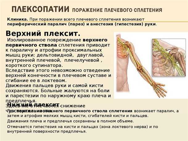 Невралгия подмышечного сплетения: клинические аспекты и лечение.