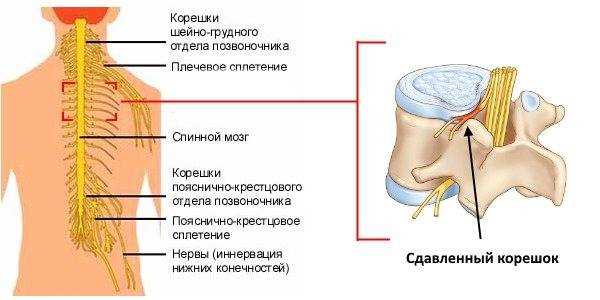 Важность физиотерапевтических методов для предотвращения рецидивов нервного воспаления