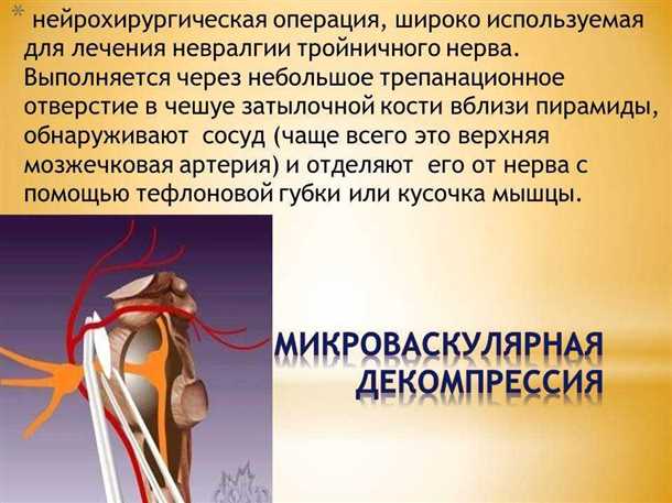 Медикаментозное лечение невралгии сакрального нерва: применение средств для облегчения симптомов