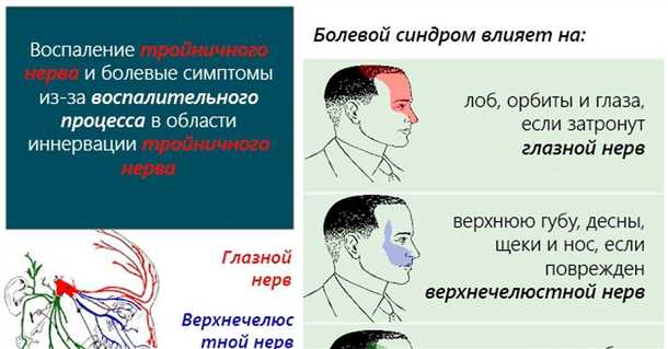 Диагностика невралгии сакрококсигеального нерва