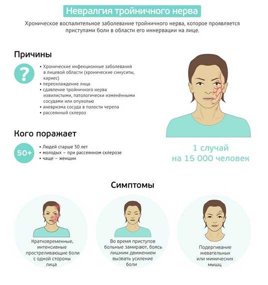 Невралгия сакрококсигеального нерва: симптомы и методы терапии.