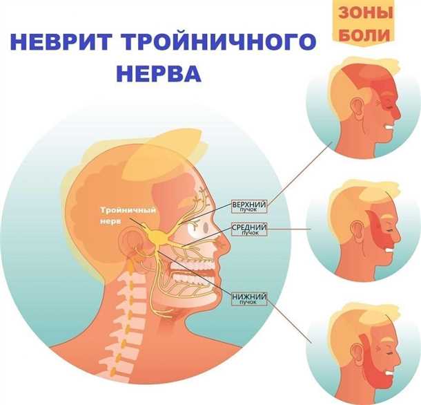 Определение