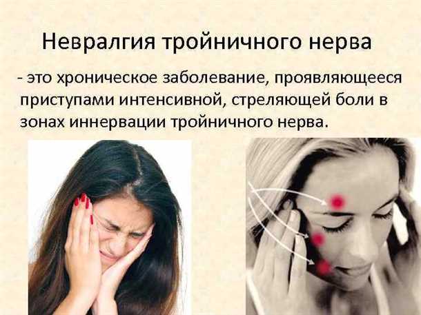Физиотерапия и альтернативные методы лечения невралгии пятого головного нерва: эффективные подходы без хирургического вмешательства