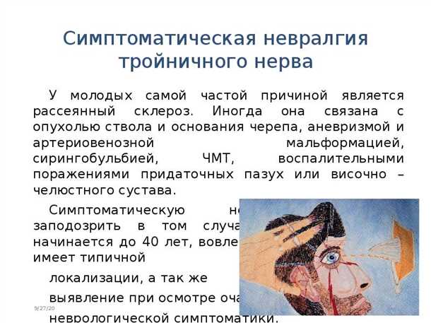 Диагностика невралгии пятого черепного нерва и инструменты для подтверждения диагноза