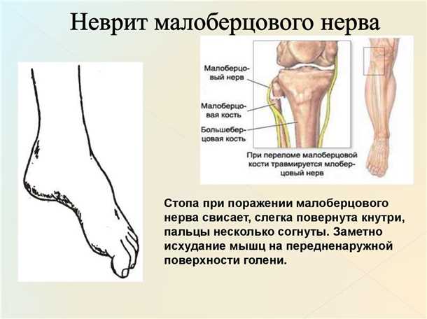 Подходы к медикаментозной терапии