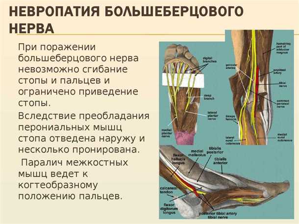 Возможные причины неврологических проблем нижних конечностей
