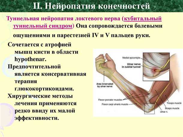 Типы лечения нервных заболеваний нижних конечностей