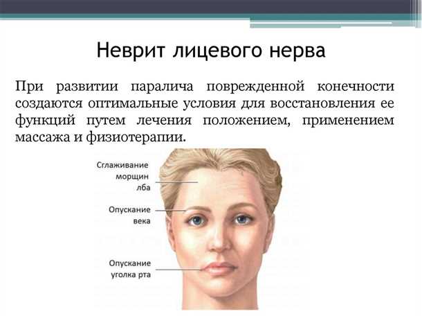 Невриты и невропатии при метаболических расстройствах: влияние на нервную систему и методы коррекции.