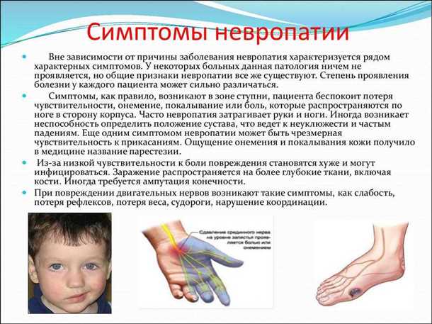 Невриты и невропатии при нарушениях пищеварения: диагностика и лечение основного заболевания.
