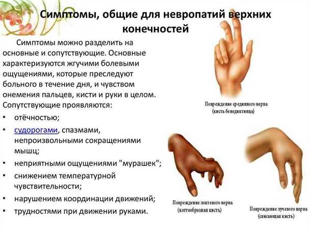 Связь между наследственными неврологическими заболеваниями и ревматическими проявлениями