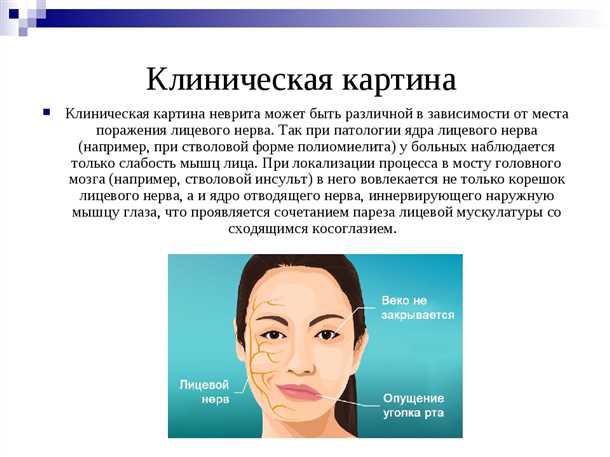 Патогенез неврологических нарушений при воздействии токсических веществ