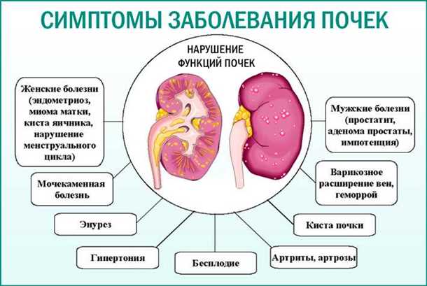 Неврологические аспекты болезней почек (например, хроническая почечная недостаточность)