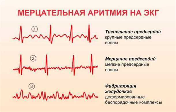 Эмоциональный стресс и риск развития сердечно-сосудистых заболеваний