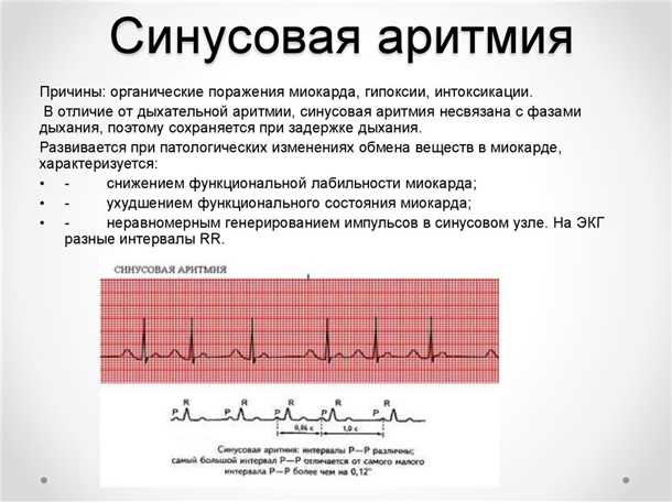 Роль нервной системы в развитии аритмий: взаимосвязь и механизмы